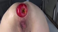 Extreme Rectal Fisting And Giant Apple Insertions